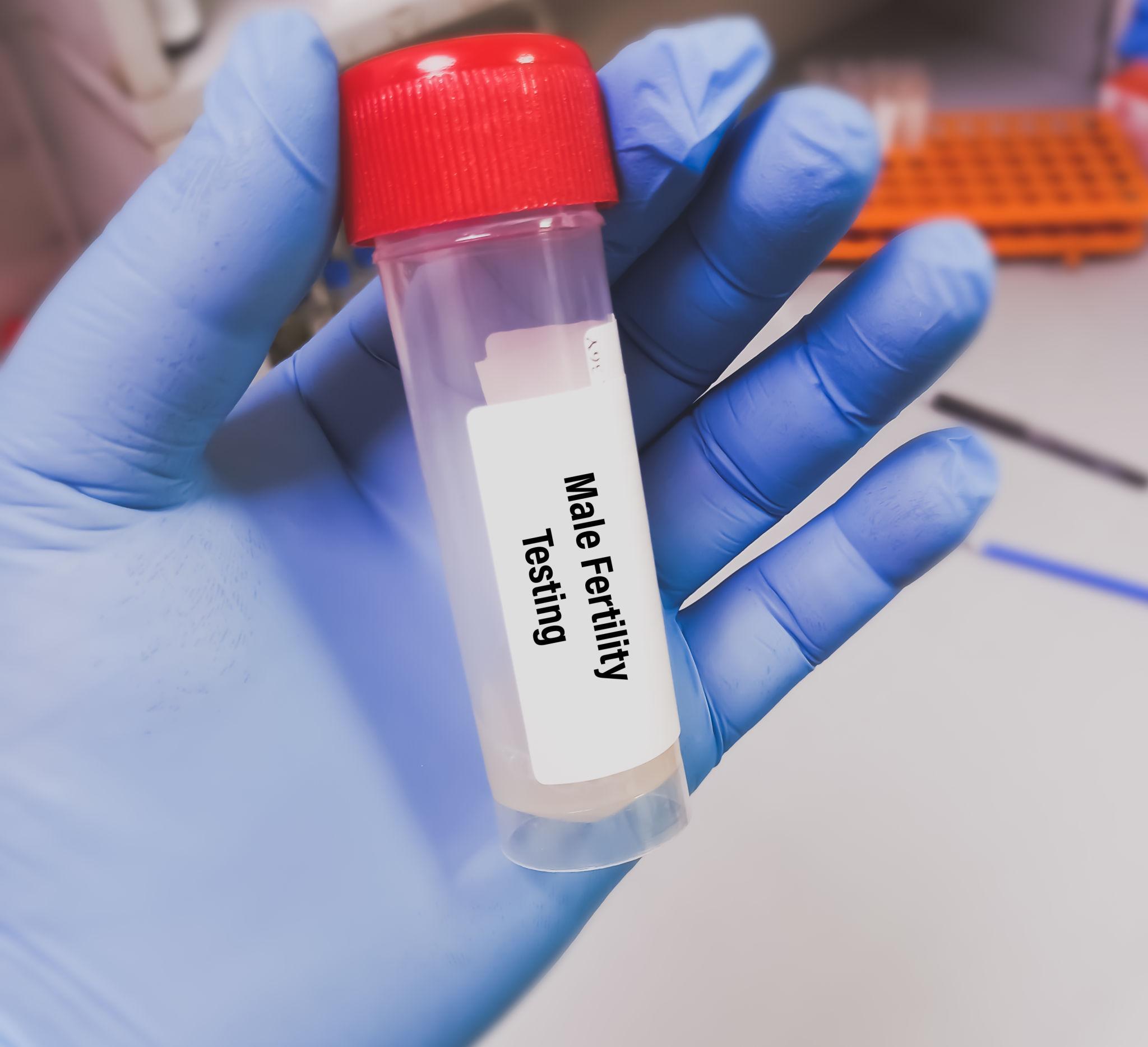 Male sperm Count